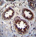 EIF4EBP1 / 4EBP1 Antibody - EIF4EBP1 Antibody immunohistochemistry of formalin-fixed and paraffin-embedded human breast tissue followed by peroxidase-conjugated secondary antibody and DAB staining.