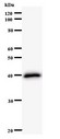 EIF4ENIF1 / 4E-T Antibody - Western blot of immunized recombinant protein using EIF4ENIF1 antibody.