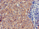 EIF4ENIF1 / 4E-T Antibody - Immunohistochemistry of paraffin-embedded human liver tissue at dilution of 1:100