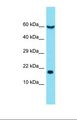 EIF5A Antibody - Western blot of Human NCI-H226. EIF5A antibody dilution 1.0 ug/ml.  This image was taken for the unconjugated form of this product. Other forms have not been tested.