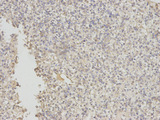 EIF5A Antibody - Immunohistochemistry of paraffin-embedded human liver using EIF5A antibody at dilution of 1:200 (200x lens).