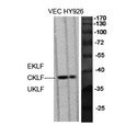 EKLF / KLF1 Antibody - Western blot of EKLF/CKLF/UKLF antibody
