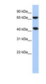 ELAC1 Antibody - ELAC1 antibody Western blot of HepG2 cell lysate. This image was taken for the unconjugated form of this product. Other forms have not been tested.