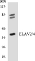 ELAV Like / ELAVL2 + ELAVL4 Antibody - Western blot analysis of the lysates from 293 cells using ELAV2/4 antibody.