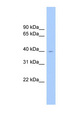 ELAVL2 / HUB Antibody - ELAVL2 / HuB antibody Western blot of Fetal Brain lysate. This image was taken for the unconjugated form of this product. Other forms have not been tested.