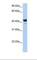 ELF3 / ESE1 Antibody - MCF7 cell lysate. Antibody concentration: 1.0 ug/ml. Gel concentration: 12%.  This image was taken for the unconjugated form of this product. Other forms have not been tested.
