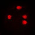 ELF5 Antibody - Immunofluorescent analysis of ELF5 staining in HUVEC cells. Formalin-fixed cells were permeabilized with 0.1% Triton X-100 in TBS for 5-10 minutes and blocked with 3% BSA-PBS for 30 minutes at room temperature. Cells were probed with the primary antibody in 3% BSA-PBS and incubated overnight at 4 C in a humidified chamber. Cells were washed with PBST and incubated with a DyLight 594-conjugated secondary antibody (red) in PBS at room temperature in the dark. DAPI was used to stain the cell nuclei (blue).