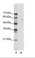 ELK1 Antibody - A: Marker, B: Jurkat Cell Lysate.  This image was taken for the unconjugated form of this product. Other forms have not been tested.