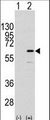 ELK1 Antibody - Western blot of ELK1 (arrow) using rabbit polyclonal ELK1 Antibody (S383) (RB11172). 293 cell lysates (2 ug/lane) either nontransfected (Lane 1) or transiently transfected with the ELK1 gene (Lane 2) (Origene Technologies).