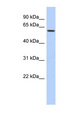 ELL / MEN Antibody - ELL antibody Western blot of PANC1 cell lysate. This image was taken for the unconjugated form of this product. Other forms have not been tested.