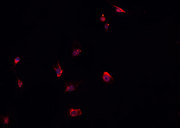ELMO1 / ELMO 1 Antibody - Staining HepG2 cells by IF/ICC. The samples were fixed with PFA and permeabilized in 0.1% Triton X-100, then blocked in 10% serum for 45 min at 25°C. The primary antibody was diluted at 1:200 and incubated with the sample for 1 hour at 37°C. An Alexa Fluor 594 conjugated goat anti-rabbit IgG (H+L) antibody, diluted at 1/600, was used as secondary antibody.