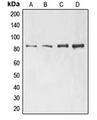 ELMO1 / ELMO 1 Antibody - Western blot analysis of ELMO1 expression in Jurkat (A); H1299 (B); HeLa (C); HL60 (D) whole cell lysates.