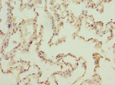 ELMOD1 Antibody - Immunohistochemistry of paraffin-embedded human lung tissue at dilution 1:100