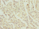 ELMOD1 Antibody - Immunohistochemistry of paraffin-embedded human lung tissue at dilution 1:100