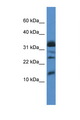 ELOF1 Antibody - ELOF1 antibody Western blot of Fetal Liver lysate. Antibody concentration 1 ug/ml.  This image was taken for the unconjugated form of this product. Other forms have not been tested.