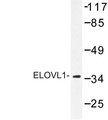 ELOVL1 Antibody - Western blot of ELOVL1 (F139) pAb in extracts from Jurkat cells.