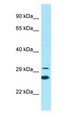 ELOVL6 Antibody - ELOVL6 antibody Western Blot of Placenta.  This image was taken for the unconjugated form of this product. Other forms have not been tested.