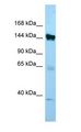 EMILIN1 / EMI Antibody - EMILIN1 / EMI antibody Western Blot of MCF7.  This image was taken for the unconjugated form of this product. Other forms have not been tested.