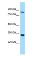EMILIN3 Antibody - EMILIN3 antibody Western Blot of HepG2.  This image was taken for the unconjugated form of this product. Other forms have not been tested.