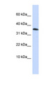 EMX1 Antibody - EMX1 antibody Western blot of HepG2 cell lysate. This image was taken for the unconjugated form of this product. Other forms have not been tested.