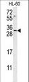 EMX2 Antibody - EMX2 Antibody western blot of HL-60 cell line lysates (15 ug/lane). The EMX2 antibody detected the EMX2 protein (arrow).