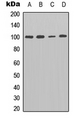 ENPP3 / CD203c Antibody - Western blot analysis of CD203c expression in MCF7 (A); SHSY5Y (B); mouse kidney (C); rat kidney (D) whole cell lysates.