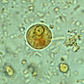 Entamoeba histolytica Antibody - Immature Entamoeba histolytica cyst