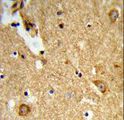 ENTPD2 Antibody - Formalin-fixed and paraffin-embedded human brain tissue reacted with ENTPD2 Antibody , which was peroxidase-conjugated to the secondary antibody, followed by DAB staining. This data demonstrates the use of this antibody for immunohistochemistry; clinical relevance has not been evaluated.