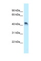ENTPD5 / CD39L4 Antibody - ENTPD5 antibody Western blot of HT1080 Cell lysate. Antibody concentration 1 ug/ml.  This image was taken for the unconjugated form of this product. Other forms have not been tested.