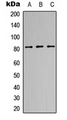Eosinophil Peroxidase / EPX Antibody - Western blot analysis of EPX HC expression in HEK293T (A); NS-1 (B); PC12 (C) whole cell lysates.