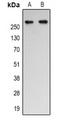 EP300 / p300 Antibody - Western blot analysis of p300 (AcK1542) expression in Jurkat (A); HeLa (B) whole cell lysates.