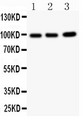 EPB41L1 / 4.1N Antibody - EPB41L1 antibody Western blot. All lanes: Anti EPB41L1 at 0.5 ug/ml. Lane 1: Rat Brain Tissue Lysate at 50 ug. Lane 2: Mouse Brain Tissue Lysate at 50 ug. Lane 3: A549 Whole Cell Lysate at 40 ug. Predicted band size: 98 kD. Observed band size: 98 kD.