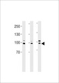 EPC1 Antibody - EPC1 Antibody western blot of A2058,HeLa cell line and mouse heart tissue lysates (35 ug/lane). The EPC1 antibody detected the EPC1 protein (arrow).