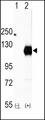 EPHA2 / EPH Receptor A2 Antibody - Western blot of EphA2 (arrow) using rabbit polyclonal EphA2 Antibody. 293 cell lysates (2 ug/lane) either nontransfected (Lane 1) or transiently transfected with the EphA2 gene (Lane 2) (Origene Technologies).