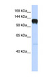 EPHA5 / EPH Receptor A5 Antibody - EPHA5 antibody Western blot of Fetal Brain lysate. This image was taken for the unconjugated form of this product. Other forms have not been tested.