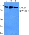 EPHA7 / EPH Receptor A7 Antibody - Western blot of p-EPHA7(Y608) antibody at 1:500 dilution. Lane 1: A549 whole cell lysate. Lane 2: sp2/0 whole cell lysate. Lane 3: PC12 whole cell lysate.