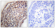 Ephrin B1+B2 Antibody - Immunohistochemistry analysis of paraffin-embedded human testis tissue, using EFNB1/2 Antibody. The picture on the right is blocked with the synthesized peptide.