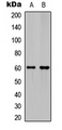 Antibody - Western blot analysis of Ephrin B1/2 expression in HeLa (A); mouse hippocampus (B) whole cell lysates.