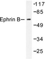 Ephrin B1+B2 Antibody - Western blot of Ephrin-B (Q324) pAb in extracts from 293 cells treated with EGF 200ng/ml 5' or 293 cells treated with TNF-a 20ng/ml 30'.