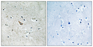Ephrin B1+B2 Antibody - Immunohistochemistry analysis of paraffin-embedded human brain, using Ephrin B1/B2 (Phospho-Tyr329) Antibody. The picture on the right is blocked with the phospho peptide.