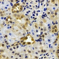 EPHX2 / Epoxide Hydrolase 2 Antibody - Immunohistochemical analysis of EPHX2 staining in rat kidney formalin fixed paraffin embedded tissue section. The section was pre-treated using heat mediated antigen retrieval with sodium citrate buffer (pH 6.0). The section was then incubated with the antibody at room temperature and detected using an HRP conjugated compact polymer system. DAB was used as the chromogen. The section was then counterstained with hematoxylin and mounted with DPX.