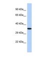 EPHX4 / Epoxide Hydrolase 4 Antibody - Western blot of Human HepG2. EPHX4 antibody dilution 1.0 ug/ml.  This image was taken for the unconjugated form of this product. Other forms have not been tested.