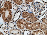 EPM2AIP1 Antibody - IHC of paraffin-embedded Human Kidney tissue using anti-EPM2AIP1 mouse monoclonal antibody.
