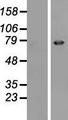 EPN3 Protein - Western validation with an anti-DDK antibody * L: Control HEK293 lysate R: Over-expression lysate