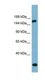 EPRS / PARS Antibody - EPRS antibody Western blot of PANC1 cell lysate. This image was taken for the unconjugated form of this product. Other forms have not been tested.
