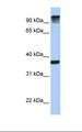 EPS15 Antibody - 721_B cell lysate. Antibody concentration: 1.0 ug/ml. Gel concentration: 12%.  This image was taken for the unconjugated form of this product. Other forms have not been tested.