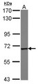 Epsin 1 / EPN1 Antibody - Sample (30 ug of whole cell lysate) A: HeLa 15% SDS PAGE EPN1 / Epsin-1 antibody diluted at 1:500