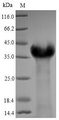 LMP1 Protein - (Tris-Glycine gel) Discontinuous SDS-PAGE (reduced) with 5% enrichment gel and 15% separation gel.