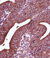 ER Alpha / Estrogen Receptor Antibody - ESR1/ER Antibody immunohistochemistry of formalin-fixed and paraffin-embedded human uterus tissue followed by peroxidase-conjugated secondary antibody and DAB staining.