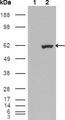 ER81 / ETV1 Antibody - Western blot using ETV1 mouse monoclonal antibody against HEK293T cells transfected with the pCMV6-ENTRY control (1) and pCMV6-ENTRY ETV1 cDNA (2).